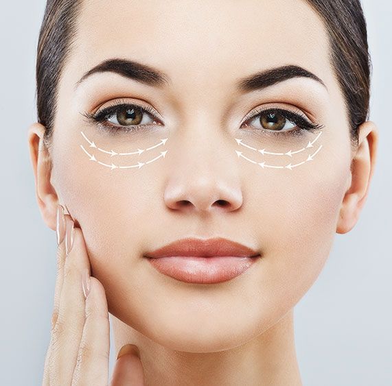 Eyelid Surgery Patient Photos - Long Island, NY