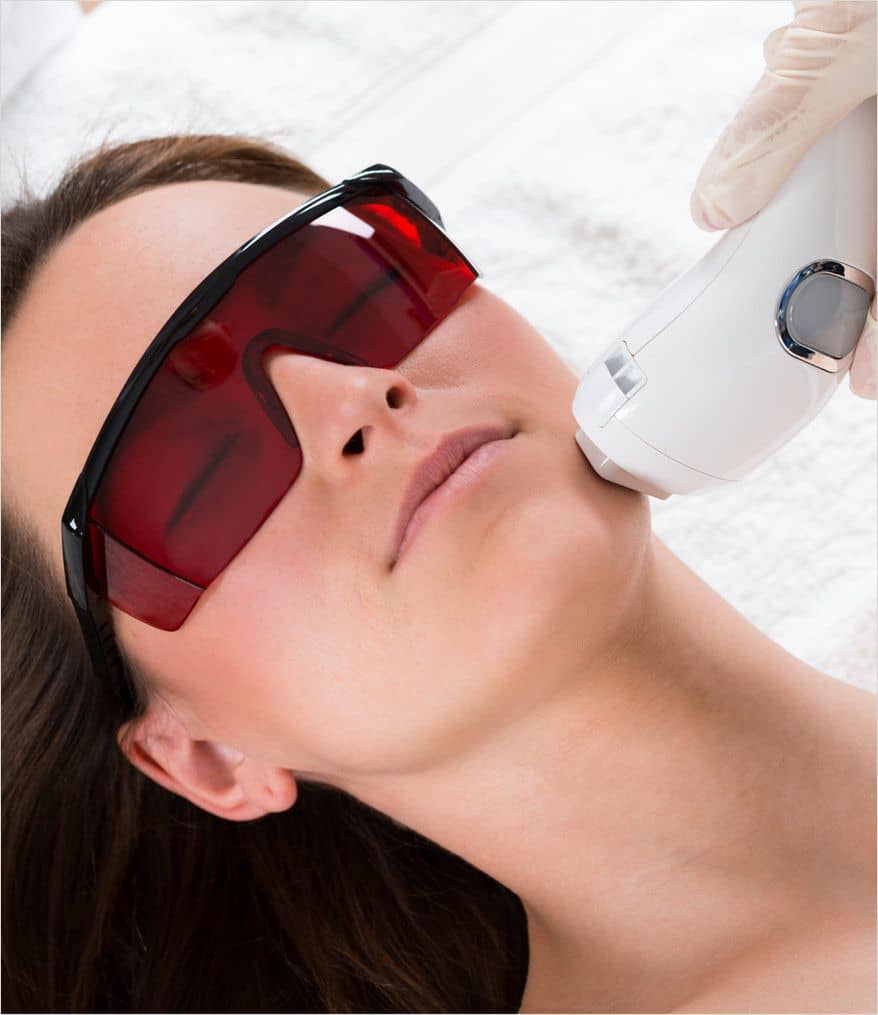 IPL Treatment on Long Island, NY