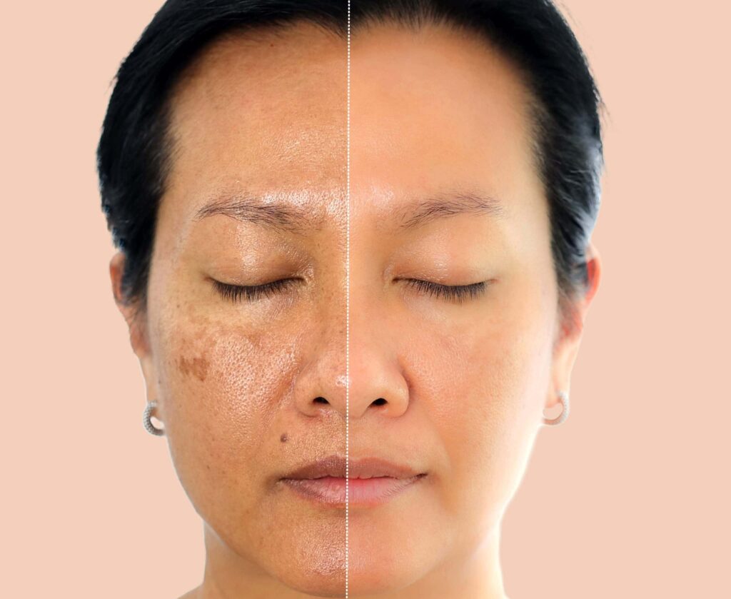 Non-invasive procedure in Roslyn Heights
