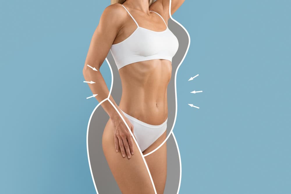 Liposuction in Roslyn Heights